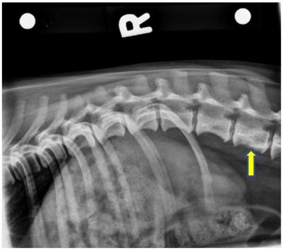 Case report: Corpectomy and iliac crest bone autograft as treatment for a vertebral plasma cell tumor in a dachshund dog